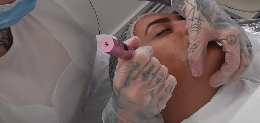 Advanced Facials Leicester