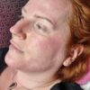 Editable Microneedling Course Manual