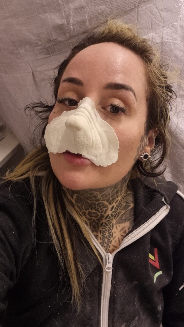 button nose