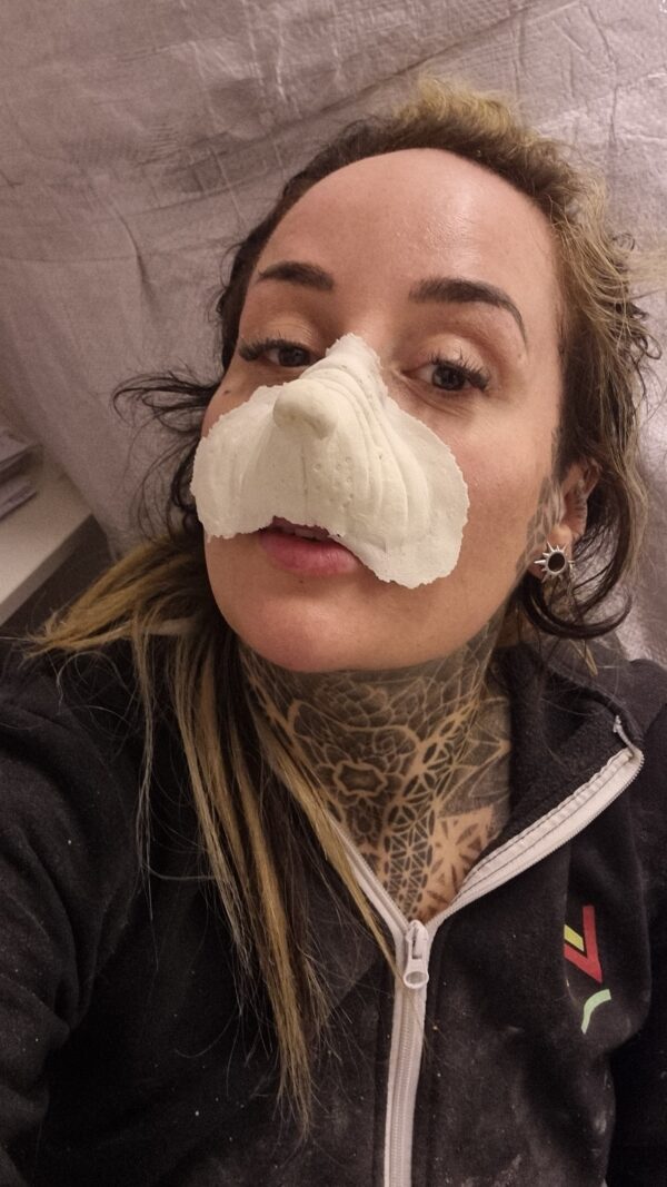 button nose