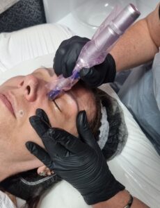 microneedling accredited certified course lesson leicester