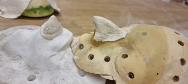 nose prosthetic