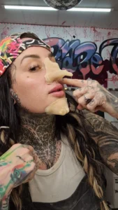 nose and chin prosthetics