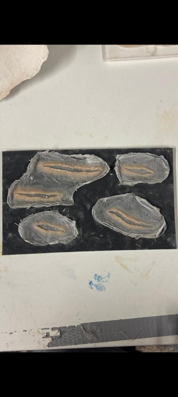 wound prosthetics