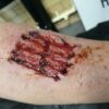 zombie bite wound