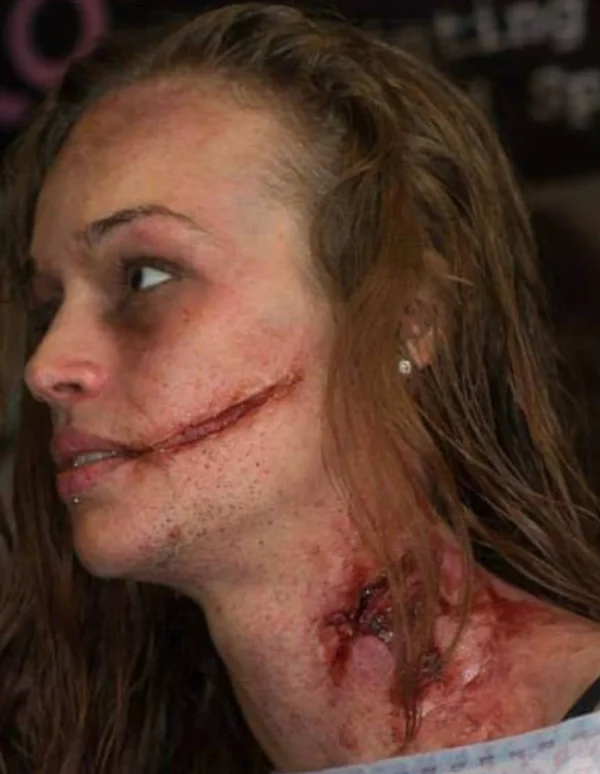 slash wounds