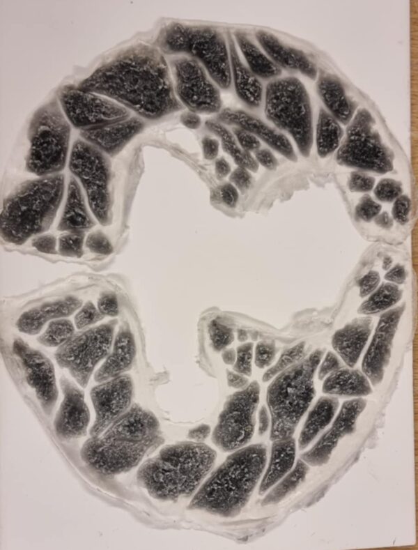 2 charcoal prosthetics