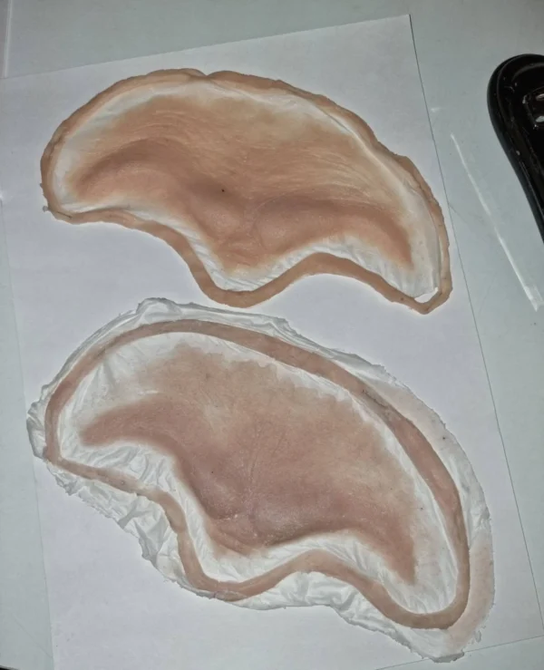 forehead prosthetics