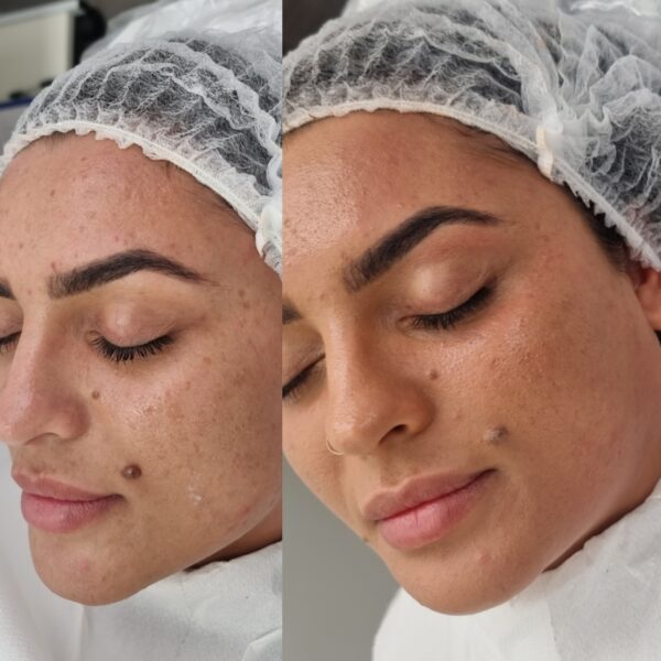 DIY facial lessons courses skin care lessons accredited