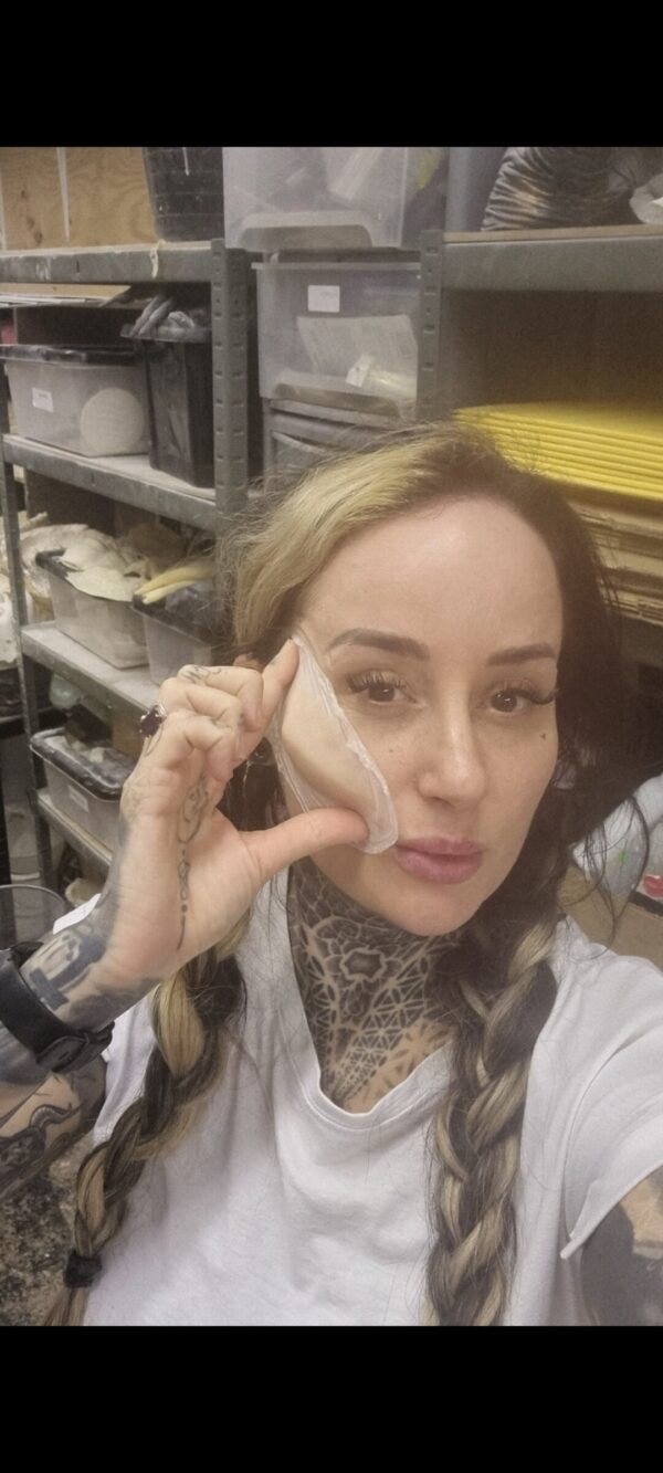 cheek prosthetics