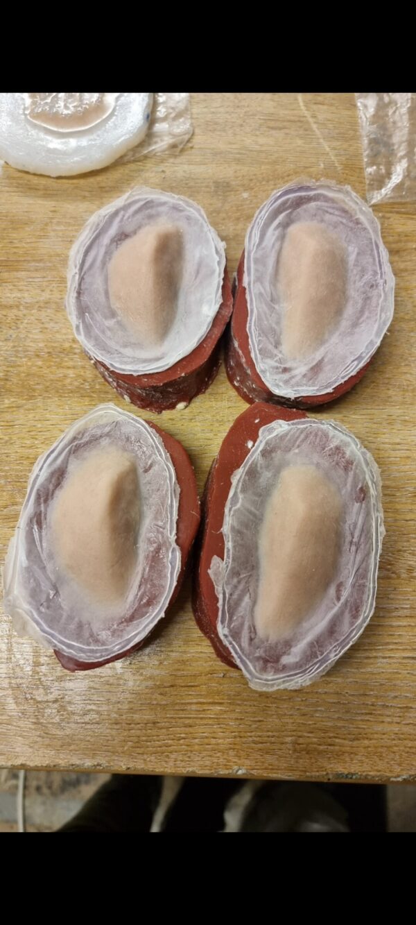 cheek prosthetics