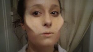2 cheek prosthetics