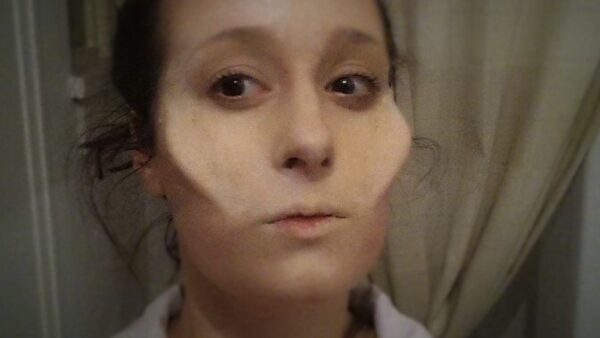 2 cheek prosthetics