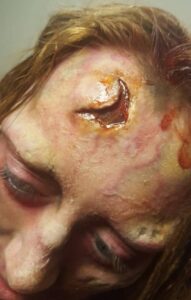 forehead injury wound prosthetic